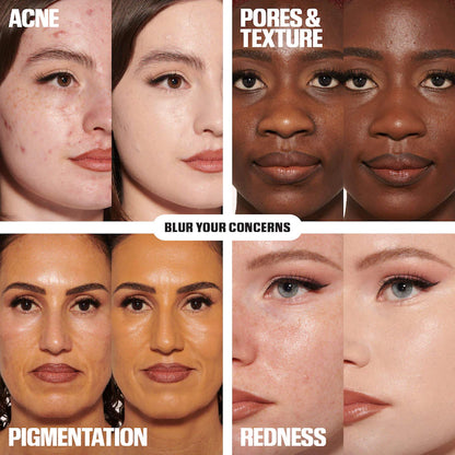 Facial skin concerns including acne, pores & texture, pigmentation, and redness with corresponding skin tones.