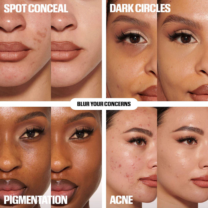 Collage of skin concerns including spots, dark circles, pigmentation, and acne with corresponding solutions.