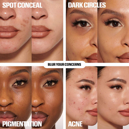 Collage of skin concerns including spots, dark circles, pigmentation, and acne with corresponding solutions.